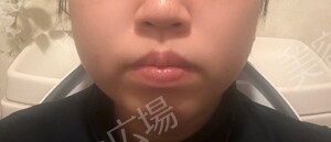 治療結果の症例写真