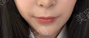 治療結果の症例写真