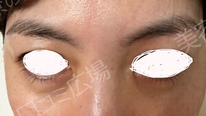 治療結果の症例写真