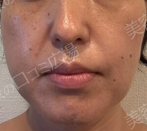 治療結果の症例写真