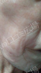 治療結果の症例写真