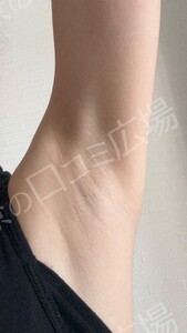 治療前の症例写真