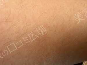 治療前の症例写真