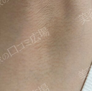 治療前の症例写真