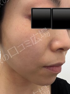 治療前の症例写真
