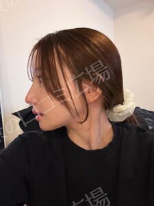 治療前の症例写真