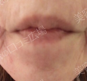 治療前の症例写真