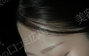 治療前の症例写真