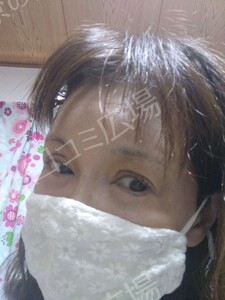 治療結果の症例写真