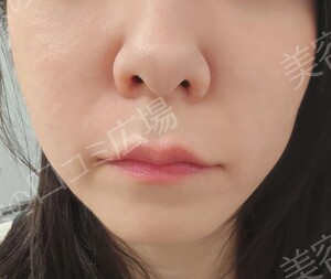 治療前の症例写真