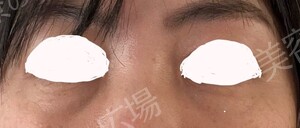 治療前の症例写真