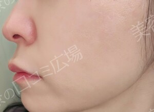 治療前の症例写真