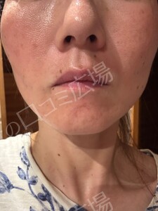 治療前の症例写真