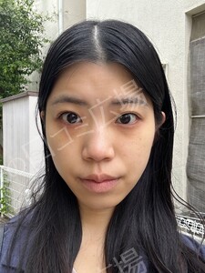 治療前の症例写真