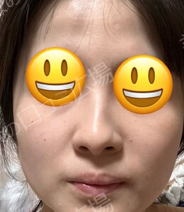 治療直後の症例写真