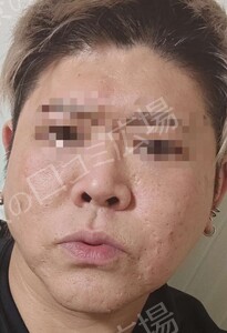 治療前の症例写真