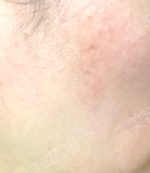 さっぽろ美容クリニック 本院の症例写真[アフター]