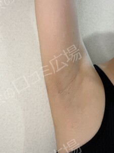 治療前の症例写真