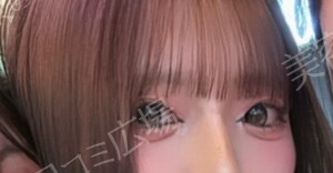 治療結果の症例写真