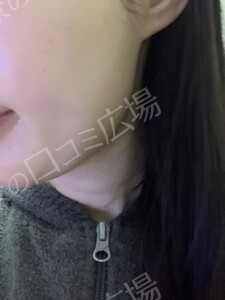 治療結果の症例写真