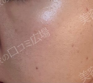 治療前の症例写真