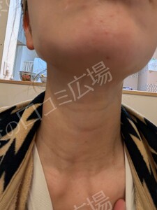 治療結果の症例写真