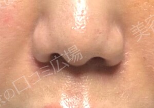 治療結果の症例写真