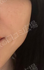 治療結果の症例写真
