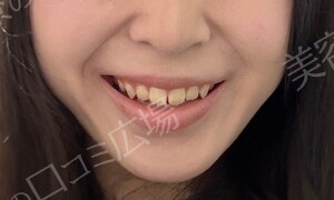 治療前の症例写真