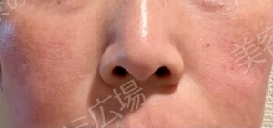 治療前の症例写真