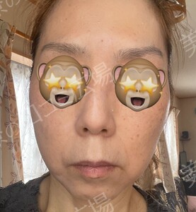 治療前の症例写真