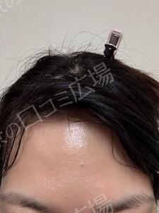 治療前の症例写真