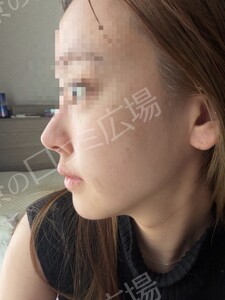 治療結果の症例写真
