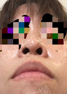 治療前の症例写真