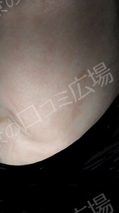 治療結果の症例写真