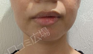 さっぽろ美容クリニック 本院の症例写真[アフター]