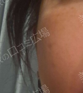 治療結果の症例写真