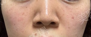 治療結果の症例写真