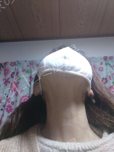治療結果の症例写真