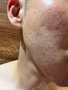 治療前の症例写真