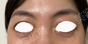 治療結果の症例写真