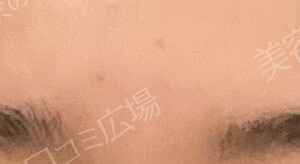 治療前の症例写真