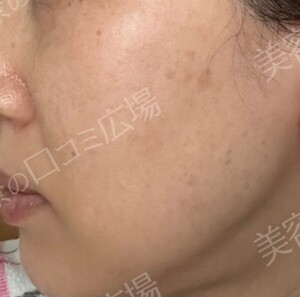 治療結果の症例写真