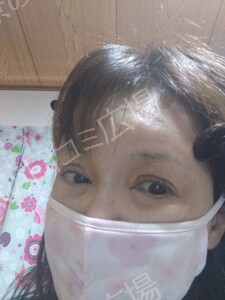 治療前の症例写真