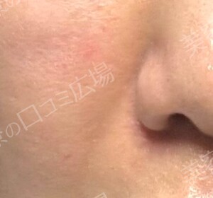 治療結果の症例写真