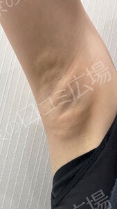 治療結果の症例写真