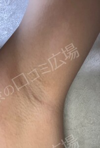 治療前の症例写真