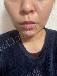 治療結果の症例写真