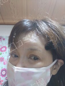 治療前の症例写真