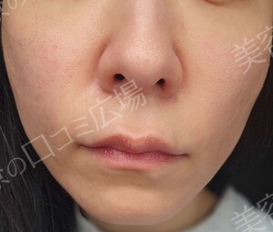 治療結果の症例写真